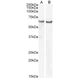 Western Blot - Anti-Frizzled 2/FZD2 Antibody (A84472) - Antibodies.com
