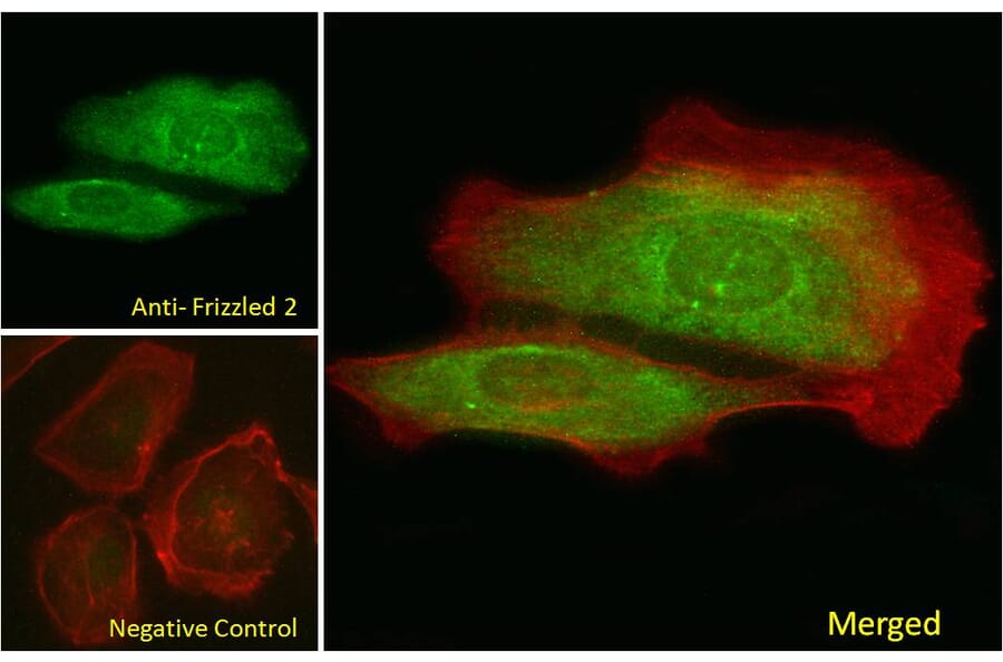Immunofluorescence - Anti-Frizzled 2/FZD2 Antibody (A84472) - Antibodies.com