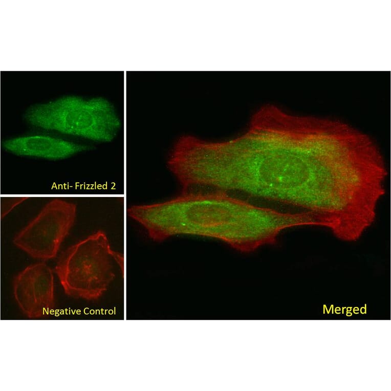 Immunofluorescence - Anti-Frizzled 2/FZD2 Antibody (A84472) - Antibodies.com