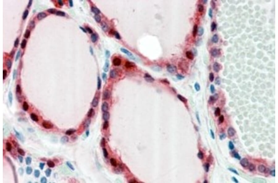 Immunohistochemistry - Anti-Frizzled 2/FZD2 Antibody (A84472) - Antibodies.com