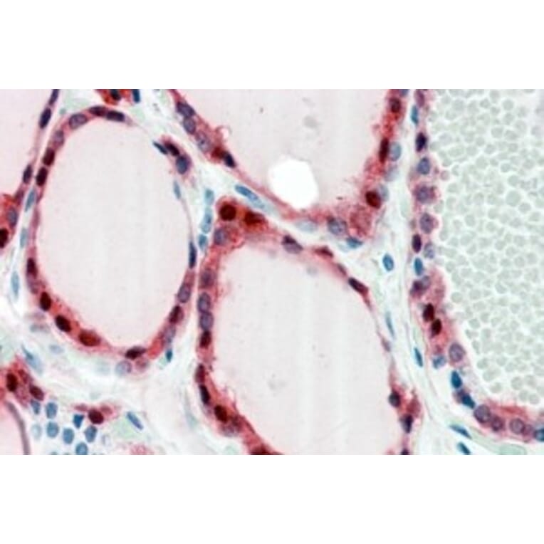 Immunohistochemistry - Anti-Frizzled 2/FZD2 Antibody (A84472) - Antibodies.com