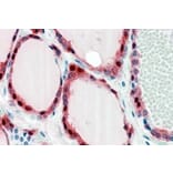 Immunohistochemistry - Anti-Frizzled 2/FZD2 Antibody (A84472) - Antibodies.com