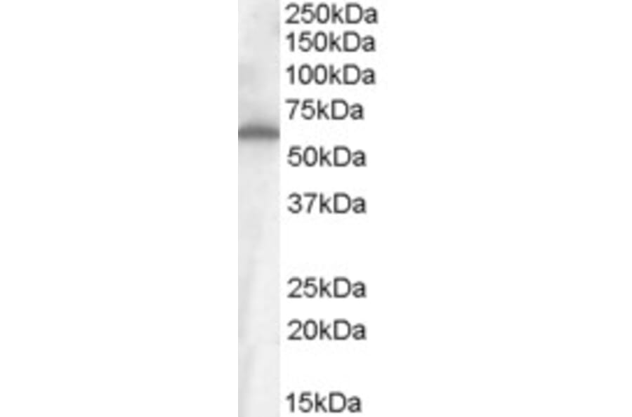 Western Blot - Anti-Frizzled 4 Antibody (A84473) - Antibodies.com