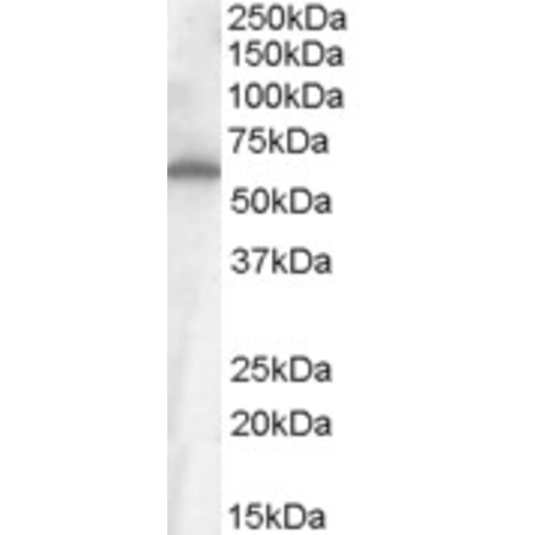 Western Blot - Anti-Frizzled 4 Antibody (A84473) - Antibodies.com