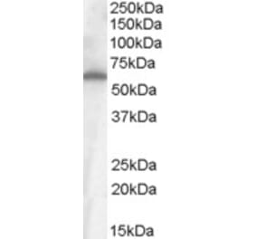 Western Blot - Anti-FZD4 Antibody (A84473) - Antibodies.com