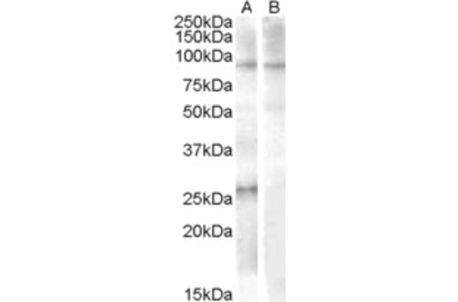 Western Blot - Anti-APOBEC2 Antibody (A84474) - Antibodies.com