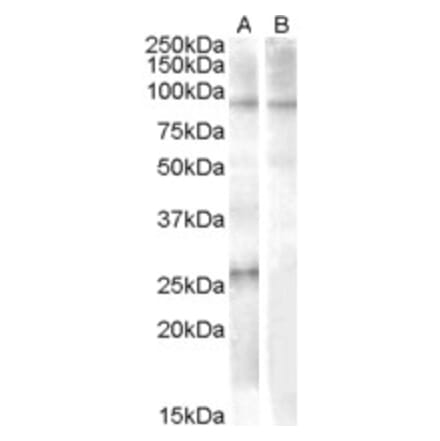 Western Blot - Anti-APOBEC2 Antibody (A84474) - Antibodies.com