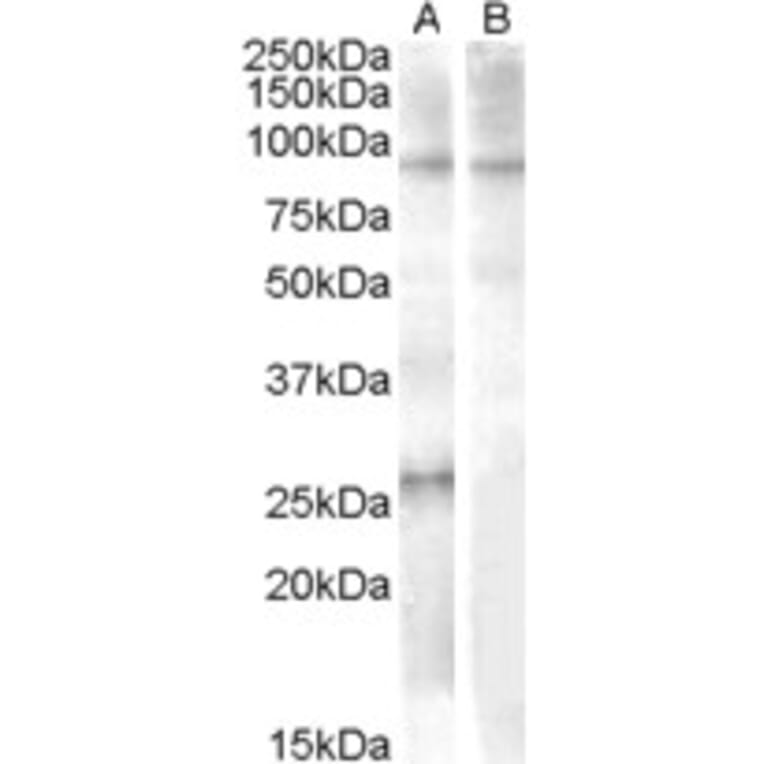 Western Blot - Anti-APOBEC2 Antibody (A84474) - Antibodies.com