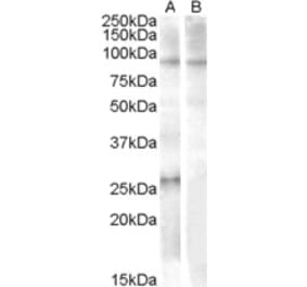 Western Blot - Anti-APOBEC2 Antibody (A84474) - Antibodies.com