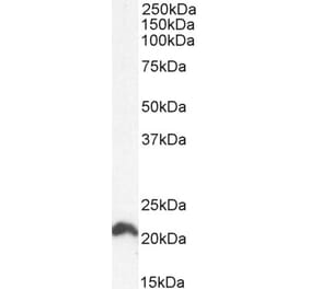 Western Blot - Anti-NRAS Antibody (A84475) - Antibodies.com