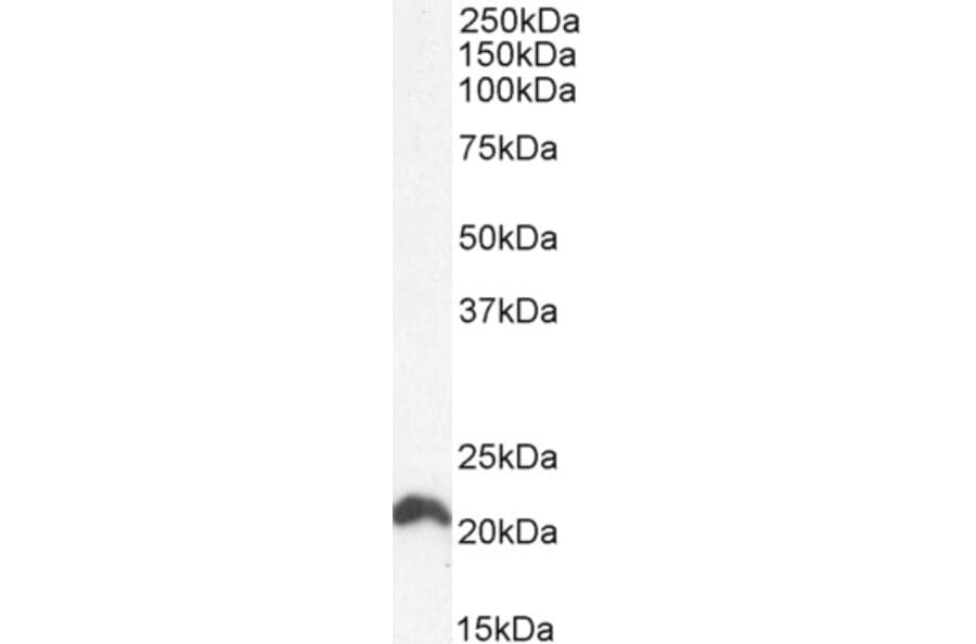Western Blot - Anti-NRAS Antibody (A84475) - Antibodies.com