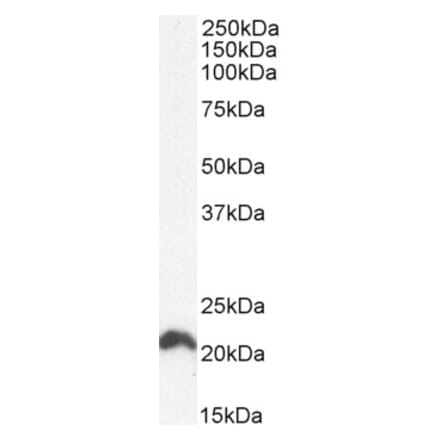 Western Blot - Anti-NRAS Antibody (A84475) - Antibodies.com