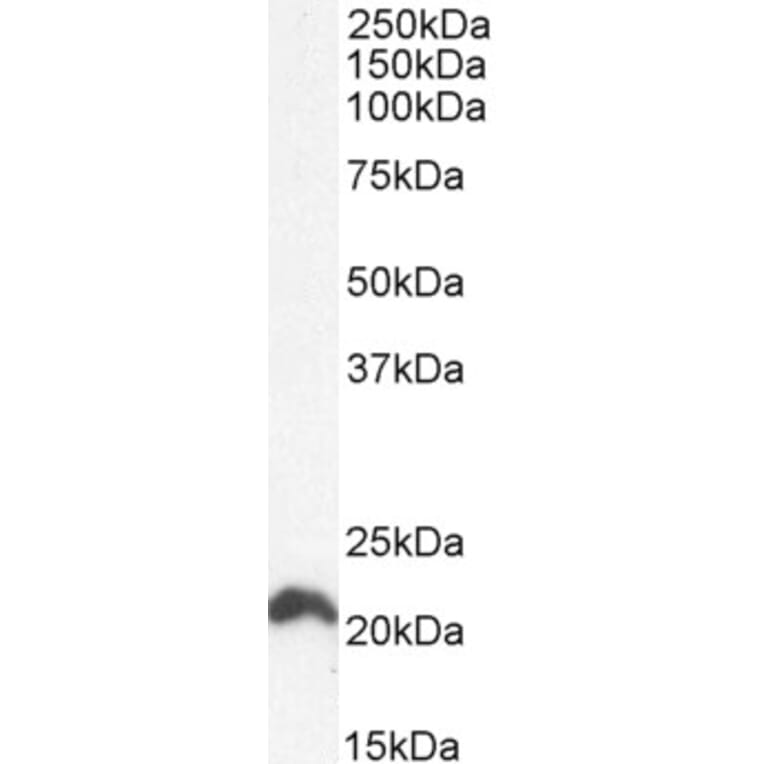 Western Blot - Anti-NRAS Antibody (A84475) - Antibodies.com