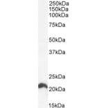 Western Blot - Anti-NRAS Antibody (A84475) - Antibodies.com