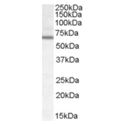 Western Blot - Anti-DACH2 Antibody (A84480) - Antibodies.com