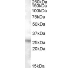 Western Blot - Anti-RASSF3 Antibody (A84481) - Antibodies.com