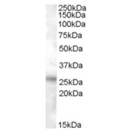 Western Blot - Anti-RASSF3 Antibody (A84481) - Antibodies.com