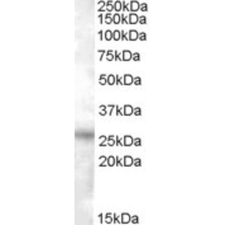 Western Blot - Anti-RASSF3 Antibody (A84481) - Antibodies.com