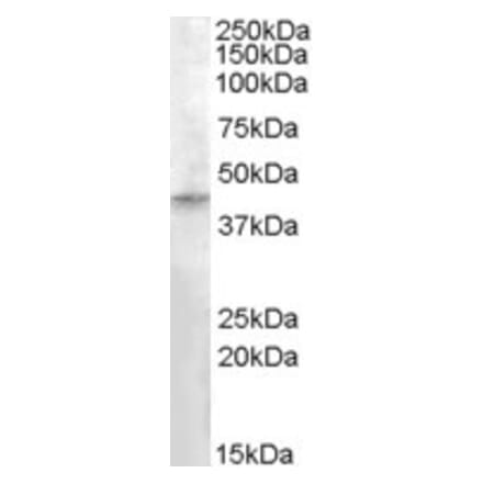Western Blot - Anti-RASSF8 Antibody (A84482) - Antibodies.com