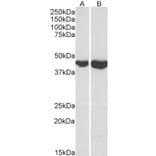 Western Blot - Anti-FABP-1 Antibody (A84483) - Antibodies.com