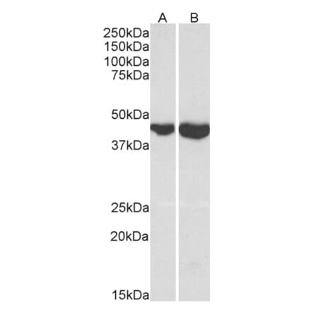 Western Blot - Anti-GOT2 Antibody (A84483) - Antibodies.com