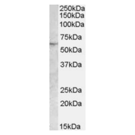 Western Blot - Anti-Adipose Triglyceride Lipase Antibody (A84484) - Antibodies.com