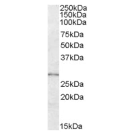 Western Blot - Anti-LYPLAL1 Antibody (A84485) - Antibodies.com