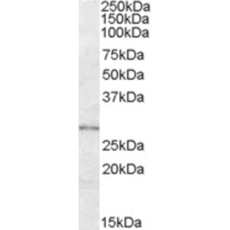Western Blot - Anti-LYPLAL1 Antibody (A84485) - Antibodies.com