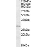 Western Blot - Anti-LYPLAL1 Antibody (A84485) - Antibodies.com