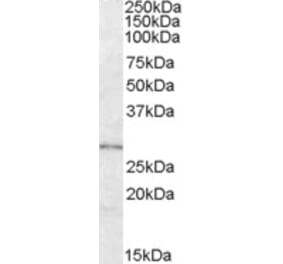 Western Blot - Anti-LYPLAL1 Antibody (A84485) - Antibodies.com