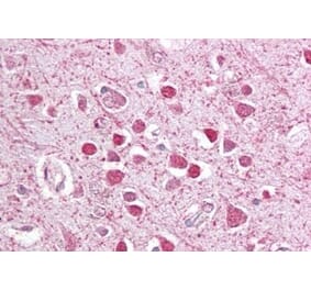 Immunohistochemistry - Anti-CEBPG Antibody (A84489) - Antibodies.com