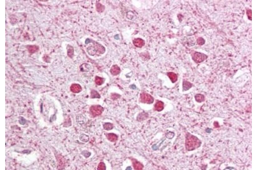 Immunohistochemistry - Anti-CEBPG Antibody (A84489) - Antibodies.com