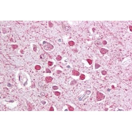 Immunohistochemistry - Anti-CEBPG Antibody (A84489) - Antibodies.com