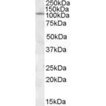 Western Blot - Anti-ICA 512/PTPRN Antibody (A84490) - Antibodies.com