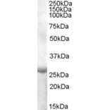 Western Blot - Anti-APOBEC2 Antibody (A84491) - Antibodies.com