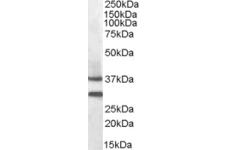 Western Blot - Anti-MC-2 Antibody (A84492) - Antibodies.com
