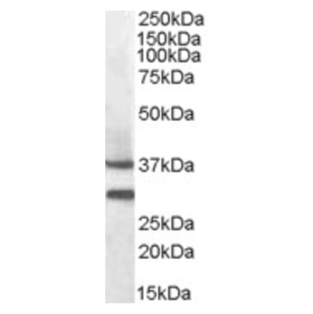 Western Blot - Anti-MC-2 Antibody (A84492) - Antibodies.com