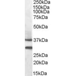 Western Blot - Anti-MC-2 Antibody (A84492) - Antibodies.com