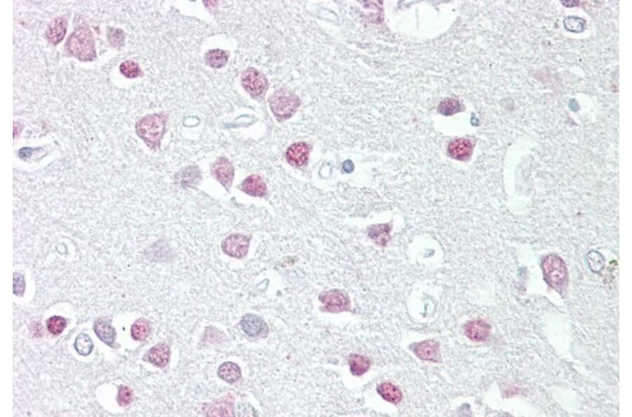 Immunohistochemistry - Anti-MC-2 Antibody (A84492) - Antibodies.com