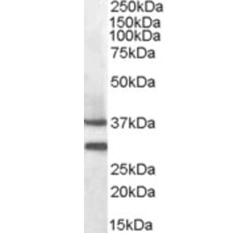 Western Blot - Anti-MC5R Antibody (A84492) - Antibodies.com
