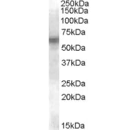 Western Blot - Anti-Lyn Antibody (A84493) - Antibodies.com