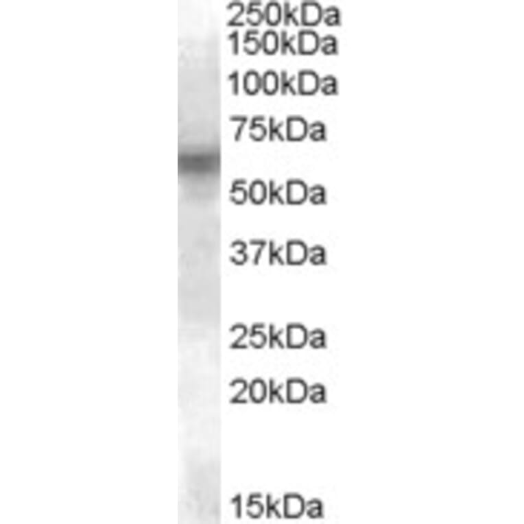 Western Blot - Anti-Lyn Antibody (A84493) - Antibodies.com