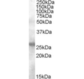 Western Blot - Anti-AICDA Antibody (A84494) - Antibodies.com