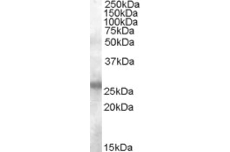 Western Blot - Anti-AICDA Antibody (A84494) - Antibodies.com