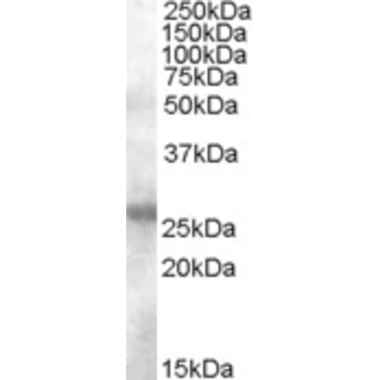 Western Blot - Anti-AICDA Antibody (A84494) - Antibodies.com