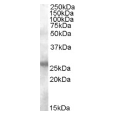 Western Blot - Anti-AICDA Antibody (A84494) - Antibodies.com
