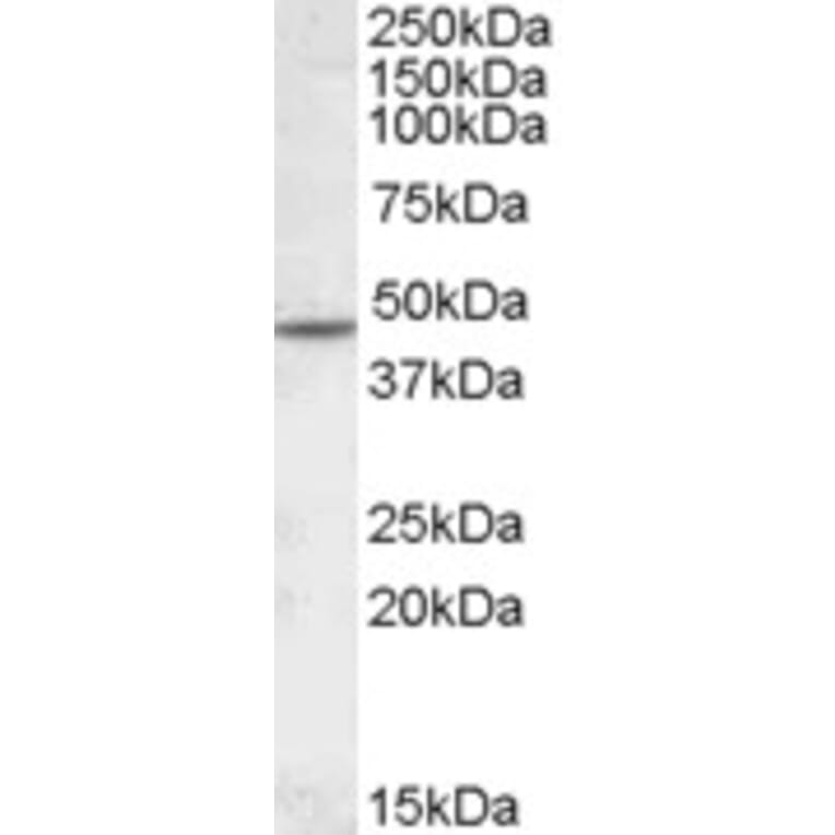 Western Blot - Anti-CHRNB2 Antibody (A84499) - Antibodies.com