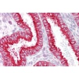 Immunohistochemistry - Anti-CHRNB2 Antibody (A84499) - Antibodies.com
