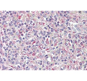 Immunohistochemistry - Anti-TRIB1 Antibody (A84501) - Antibodies.com