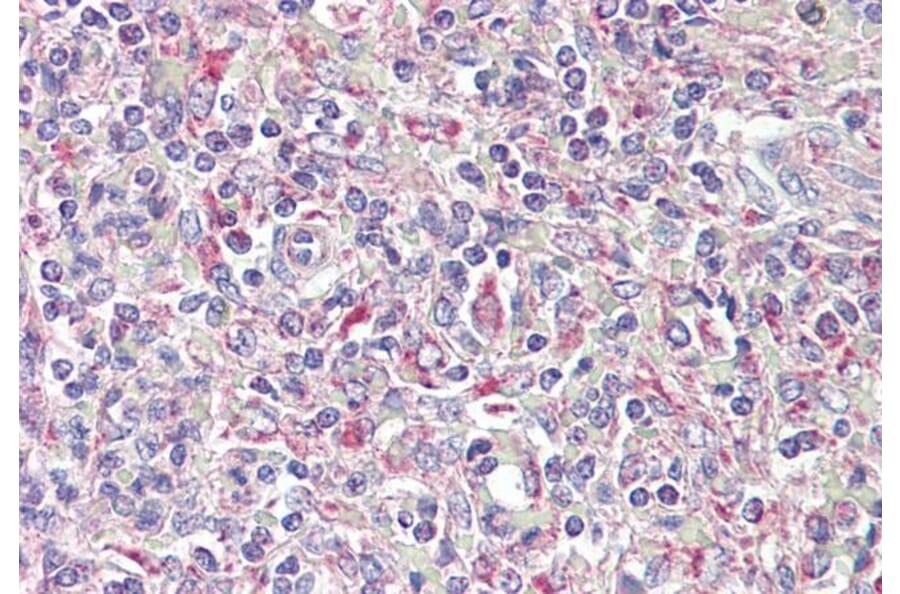 Immunohistochemistry - Anti-TRIB1 Antibody (A84501) - Antibodies.com